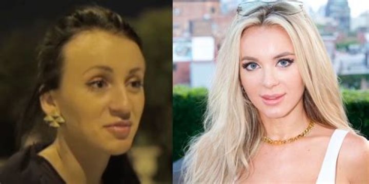 '90 Day Fiancé' Star Addicted to Plastic Surgery