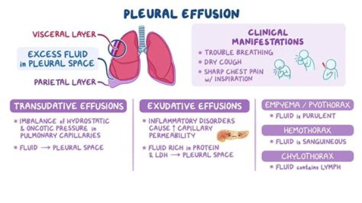 How do you calculate the effusion of a gas?