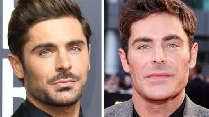 In Touch: Zac Efron actually broke his jaw last fall during ‘a drug binge’