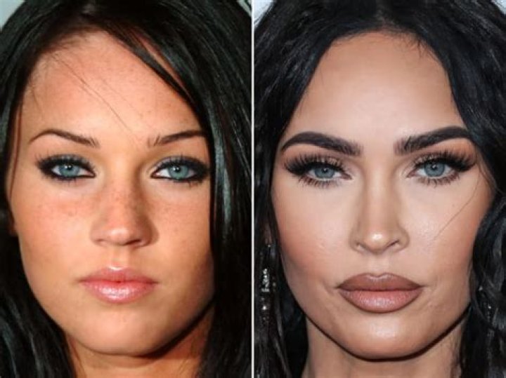 Megan Fox lifts her eyebrows up to show she hasn’t had Botox