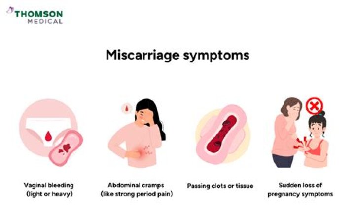 Michelle Duggar has a miscarriage in her second trimester
