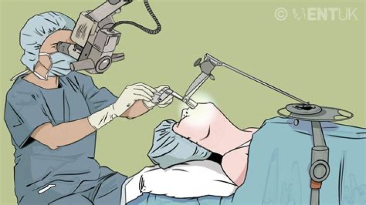 What is suspension Microlaryngoscopy?