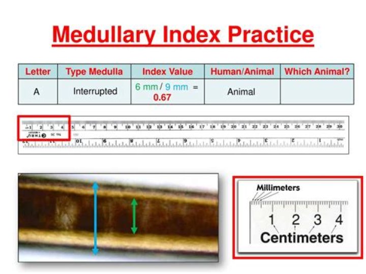 What is the medullary index used for?
